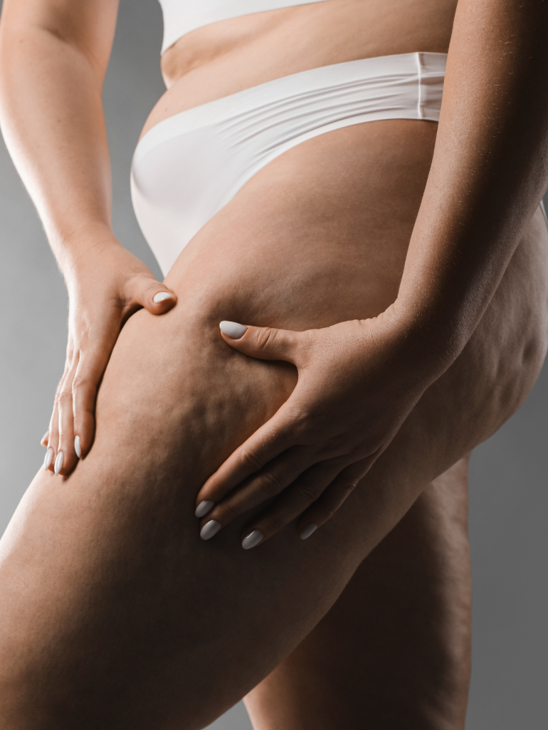 Remodelare corporală: Cum scapi de celulită și retenția de apă fără efort